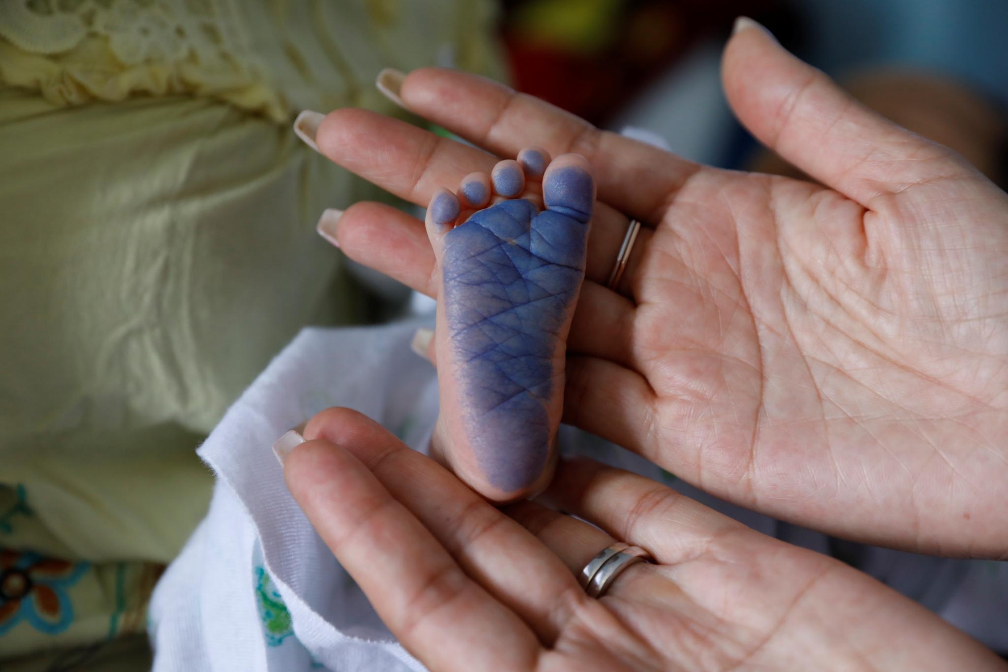 An ink marking is applied to the sole of a Burmese migrant infant’s foot for identification at Mae Tao Clinic in Mae Sot, Thailand. Credit: Shakeel.